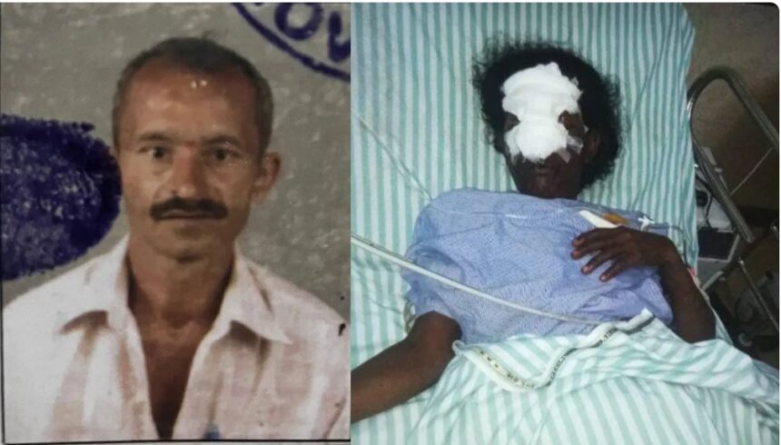 ಸಚಿವೆ ಲಕ್ಷ್ಮೀ ಹೆಬ್ಬಾಳ್ಕರ್ ತವರು ಕ್ಷೇತ್ರದಲ್ಲಿ ಅಂಗನವಾಡಿ ಸಹಾಯಕಿ ಮೂಗು ಕತ್ತರಿಸಿ ರಾಕ್ಷಸ ಕೃತ್ಯ